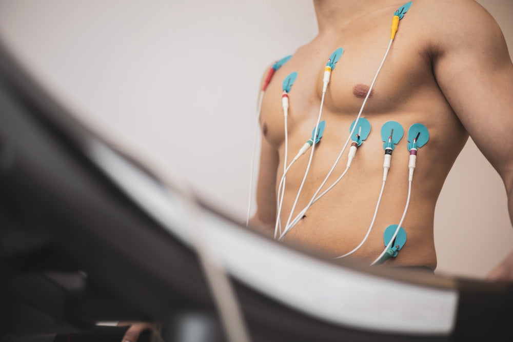 Cardiac Stress Tests: Types, Methods, and What Results Mean for Heart Health