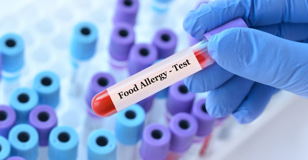 Food Allergy Panel: Identifying IgE-Mediated Food Reactions for Safer Health