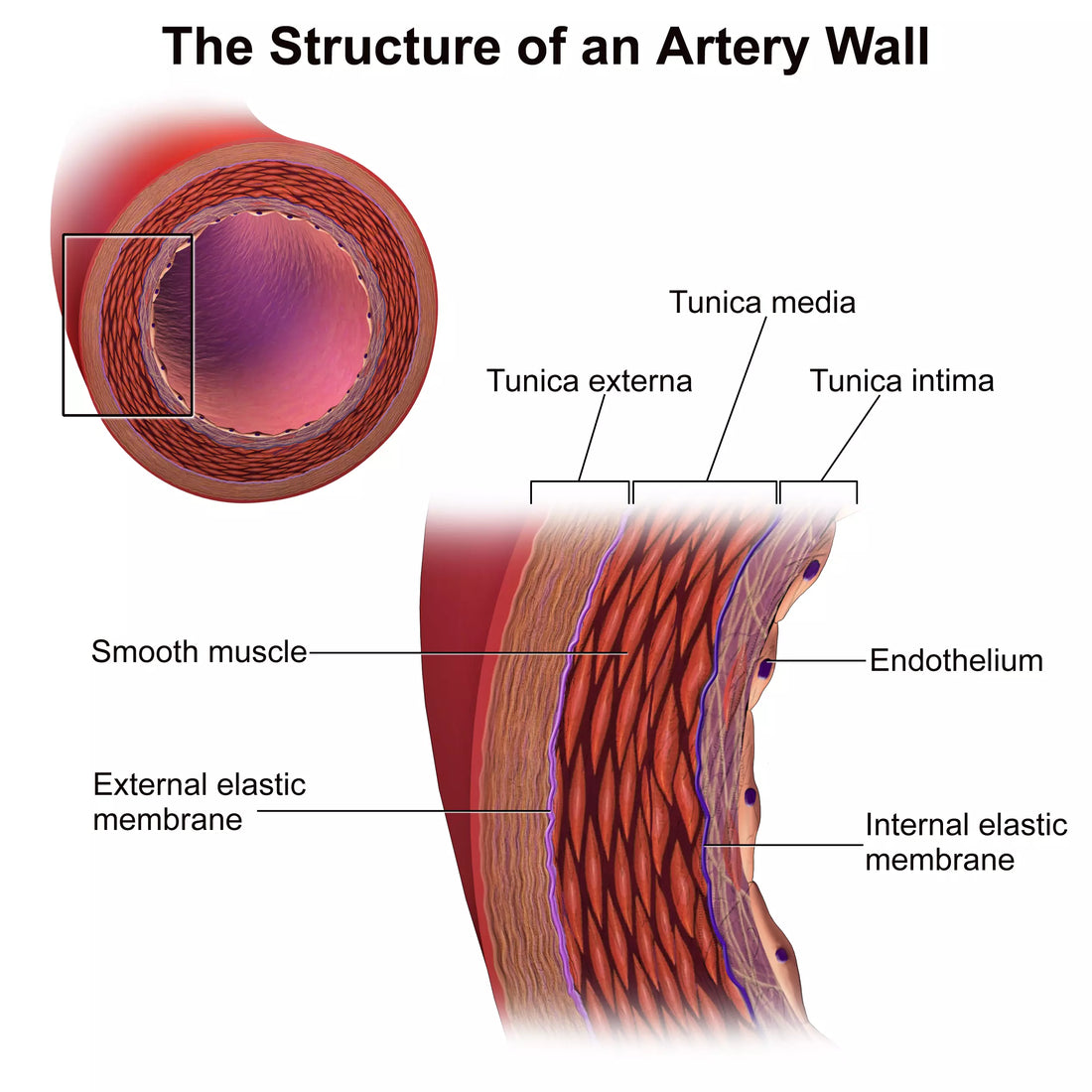 Arterial Remodeling With Hypertension