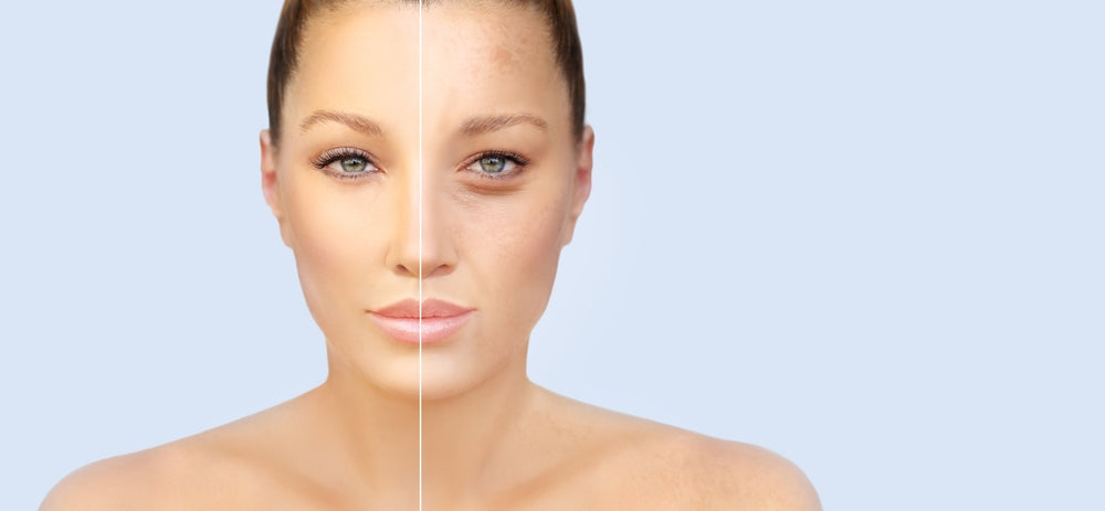 Oxidative Damage Explained